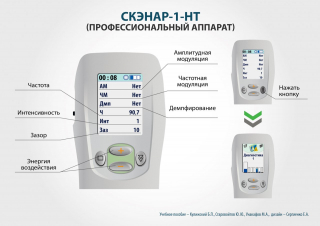 СКЭНАР-1-НТ (исполнение 01)  в Нижнекамске купить Медицинский интернет магазин - denaskardio.ru 